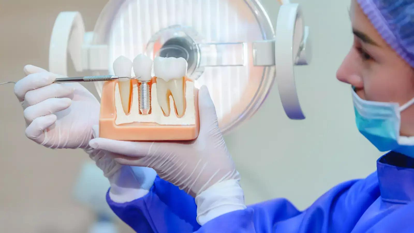 8 Different Ways Full Mouth Dental Implants Are Done