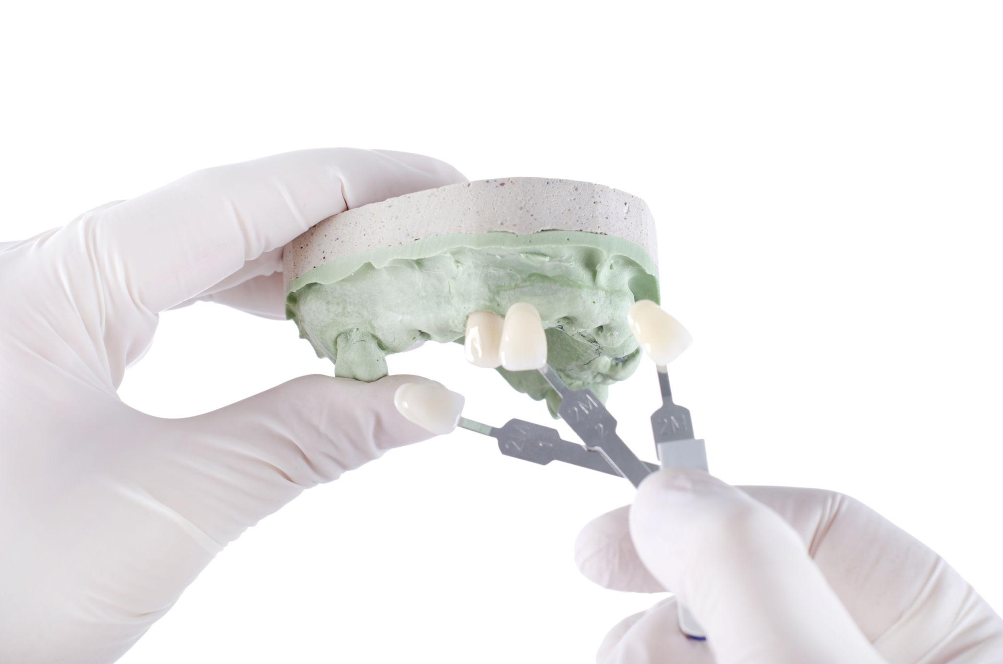 Post-op care tips for implants